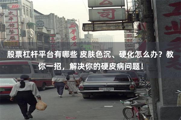 股票杠杆平台有哪些 皮肤色沉、硬化怎么办？教你一招，解决你的硬皮病问题！